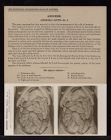 Abdomen. Abdominal Cavity - no. 2